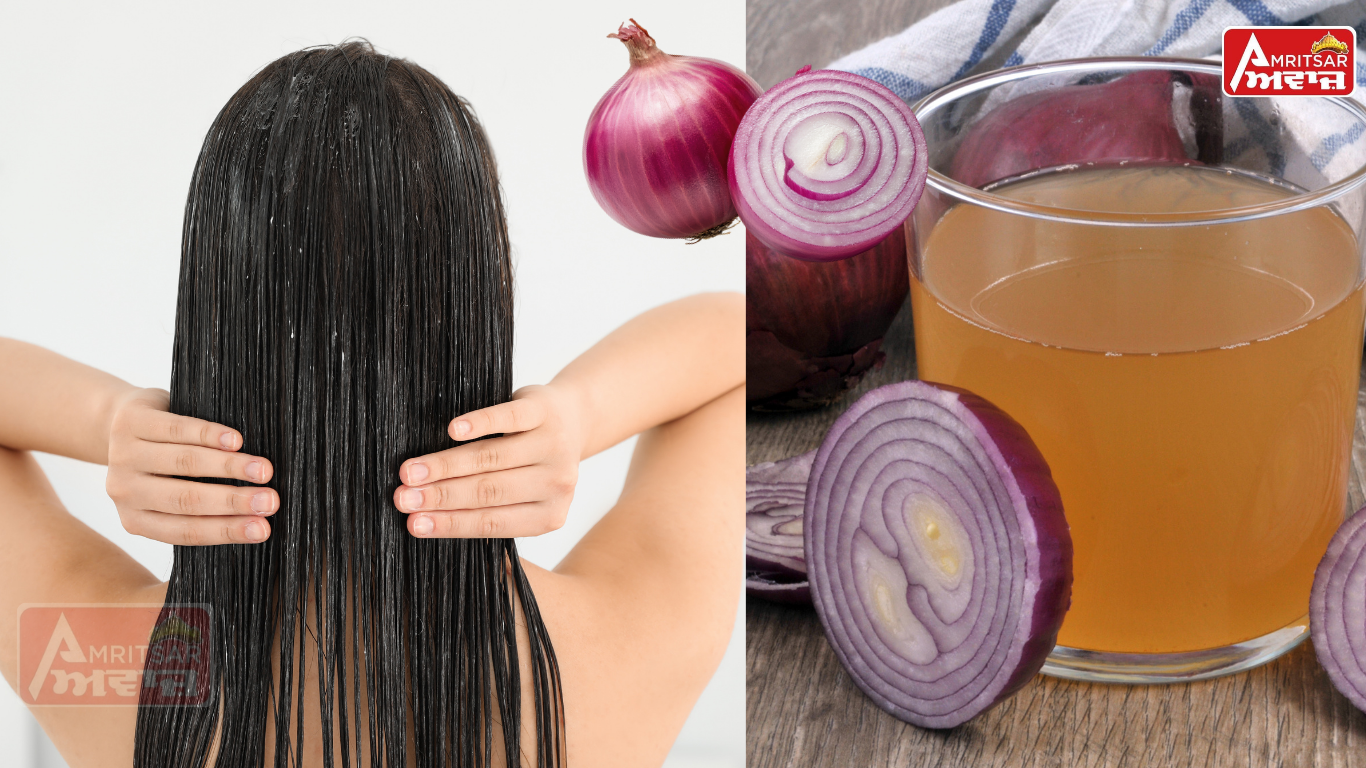 ਝੜਦੇ ਵਾਲਾਂ ਤੋਂ ਹੋ ਪ੍ਰੇਸ਼ਾਨ? ਇਸ ਤਰ੍ਹਾਂ ਲਗਾਓ ਪਿਆਜ਼ ਦਾ ਰਸ, ਕੁਝ ਹੀ ਦਿਨਾਂ ‘ਚ ਨਜ਼ਰ ਆਏਗਾ ਅਸਰ!